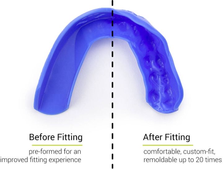 Štitnik za zube Sisu 3D Royal Blue